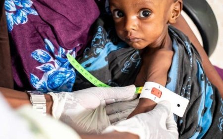 BWITO : Plus de 320 cas de malnutrition aiguë chez les enfants de moins de 5 ans