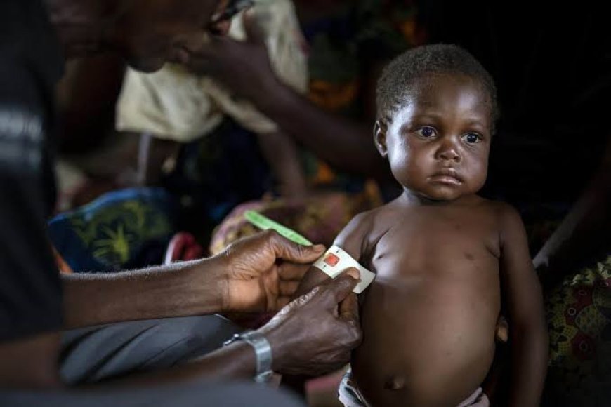 Mpox en RDC : Les enfants malnutris prioritaires dans la campagne de vaccination