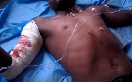 Mambasa : Un Cultivateur Blessé par un Engin Explosif à Kiterrain