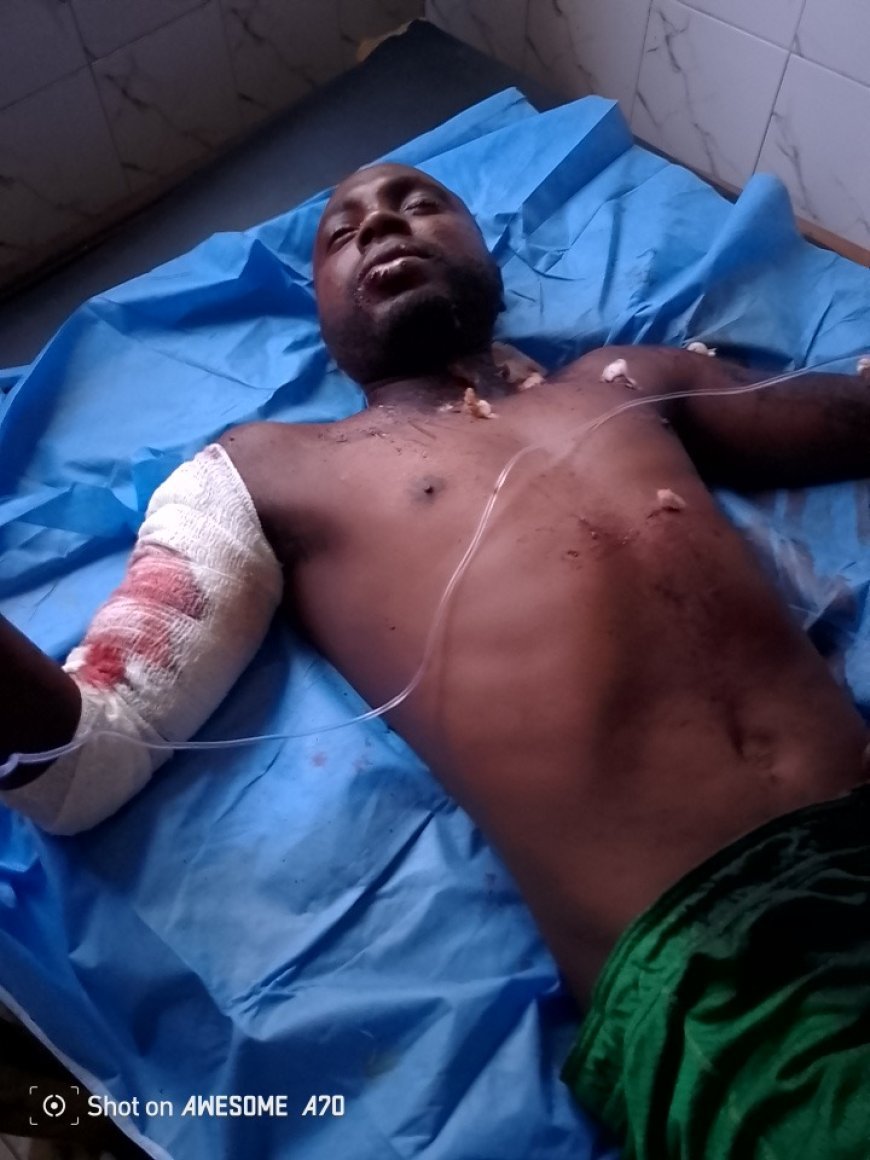 Mambasa : Un Cultivateur Blessé par un Engin Explosif à Kiterrain