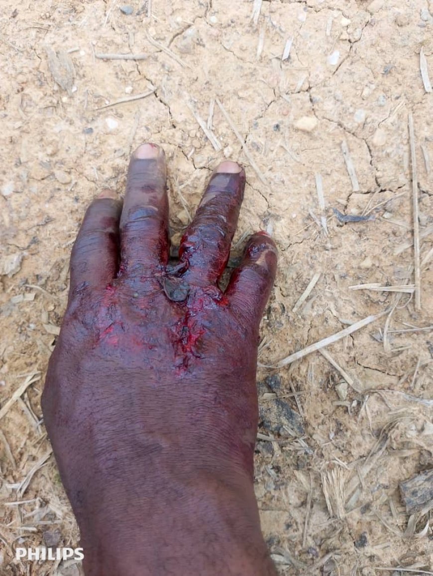 Nord-Kivu : Les « rapports café » des FARDC à Senga provoquent un accident et l'indignation de la société civile