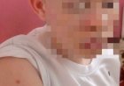 Maniema : Une adolescente atteinte d’albinisme victime d’une agression barbare à Kindu