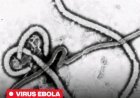 Alerte sanitaire : Un premier cas d’Ebola confirmé en France