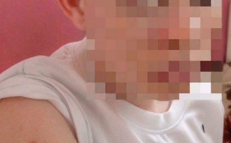 Maniema : Une adolescente atteinte d’albinisme victime d’une agression barbare à Kindu