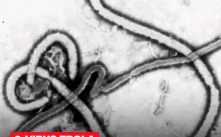 Alerte sanitaire : Un premier cas d’Ebola confirmé en France