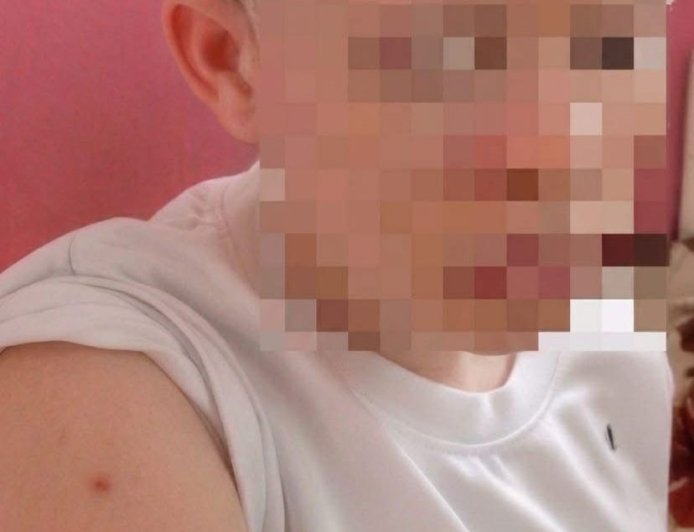 Maniema : Une adolescente atteinte d’albinisme victime d’une agression barbare à Kindu